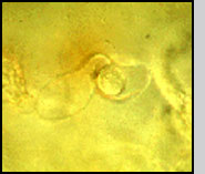 Micrographs of the sexual (oospore) stage. 
