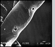 Fig. 2(B): Scanning electron micrograph of the surface of a hyphae of the plant pathogen Rhizoctonia solani after mycoparasitic Trichoderma hyphae were removed.