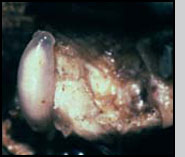 Fifth instar parasitoid (on left) on third instar boll weevil larvae inside a cotton square.