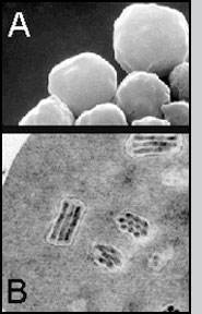 A) Baculovirus particles, or polyhedra; B) Cross-section of a polyhedron