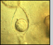 Micrographs of the sexual (oospore) stage. 
