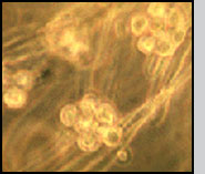Micrograph of zoospores being released from exit tubes.