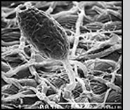 Electron micrograph of powdery mildew colony