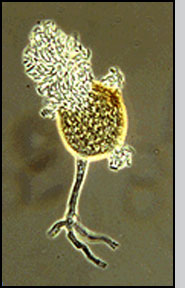 Light micrograph of a pycnidium of A. quisqualis
