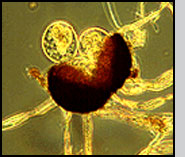 Healthy cleistothecium of the powdery mildew Uncinula necator splitting open and releasing sacs containing ascospores.