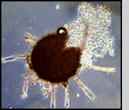 Parasitized cleistothecium of U. necator which has been ruptured and is exuding conidia of A. quisqualis. 